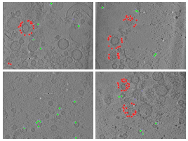 key visualization for CryoET of isolated synaptic vesicles from mouse brain