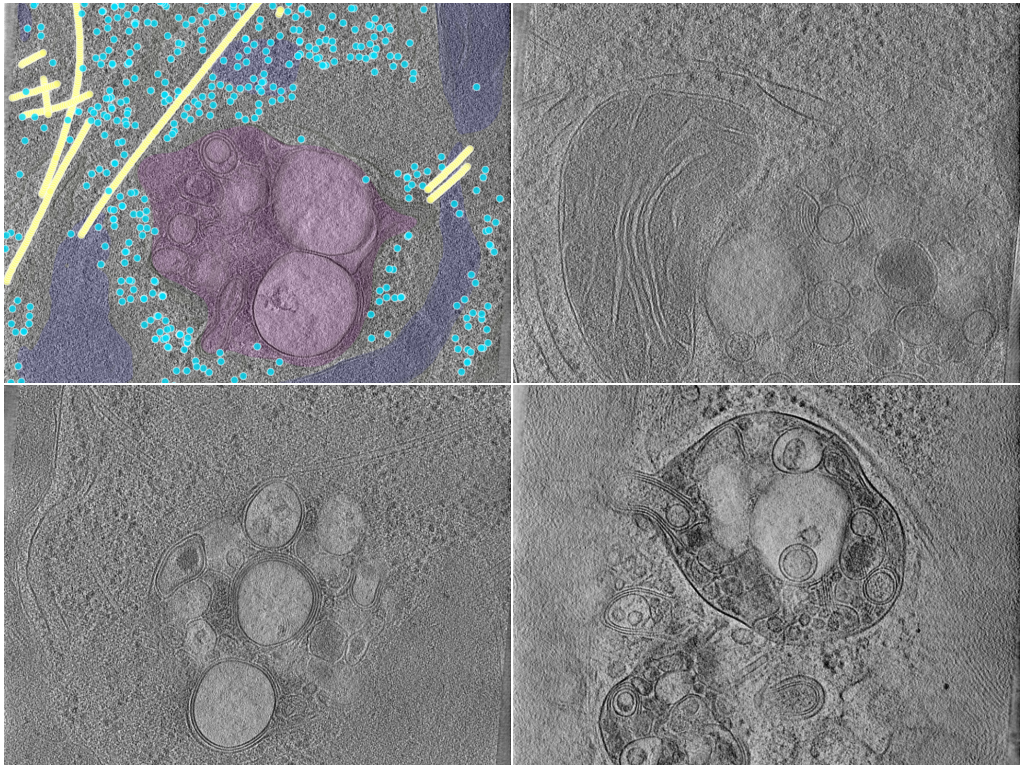 key visualization for CryoET of NPC1-Deficient Human HEK293T Cells