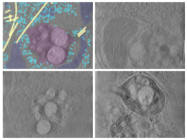 key visualization for CryoET of NPC1-Deficient Human HEK293T Cells