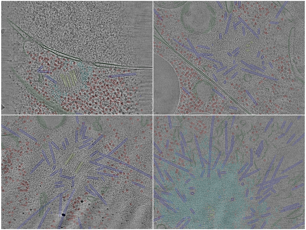 key visualization for Cryo-electron tomography of centrosomes in C. elegans embryonic cells