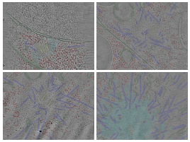 key visualization for Cryo-electron tomography of centrosomes in C. elegans embryonic cells