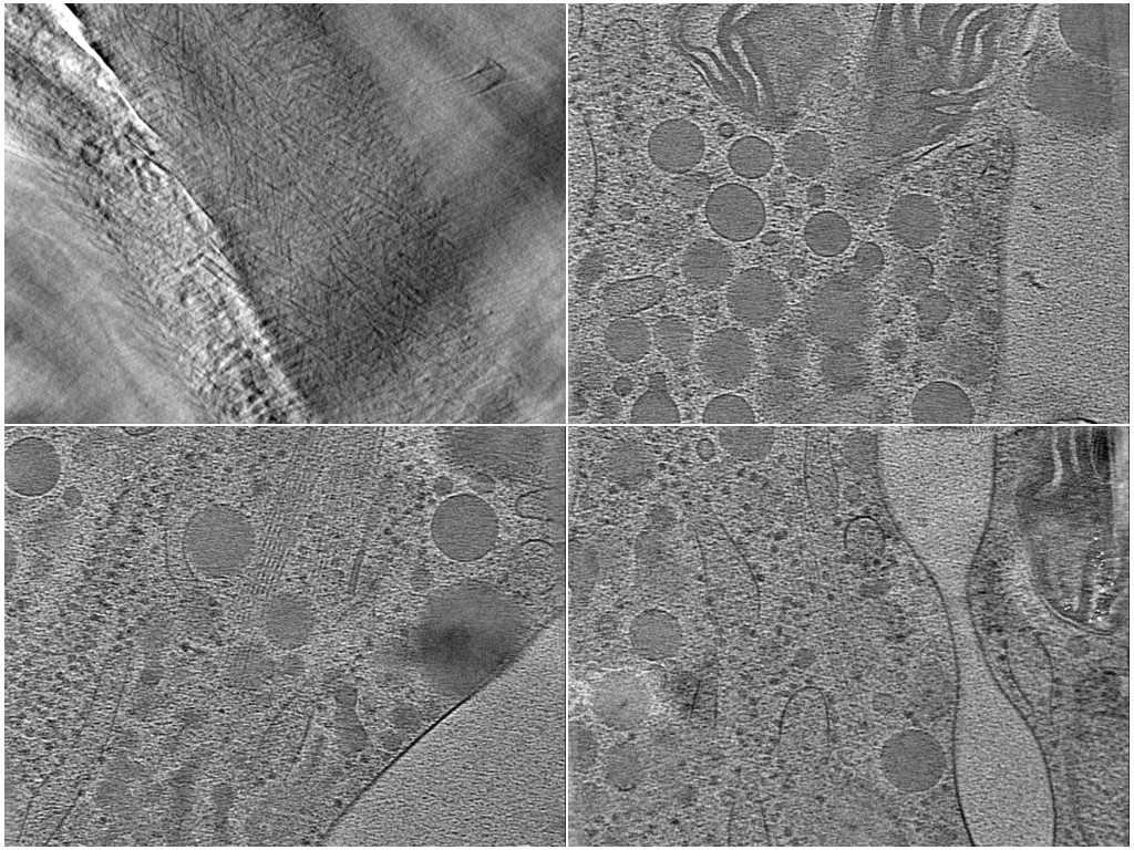 key visualization for Cryo-electron tomography of Arabidopsis thaliana — plant cell walls in CEMOVIS sections of cultured cells and intact pollen tubes in cryo-FIB lamellae