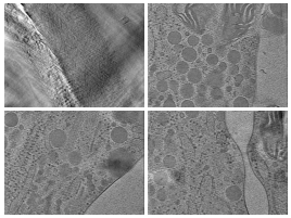 key visualization for Cryo-electron tomography of Arabidopsis thaliana — plant cell walls in CEMOVIS sections of cultured cells and intact pollen tubes in cryo-FIB lamellae