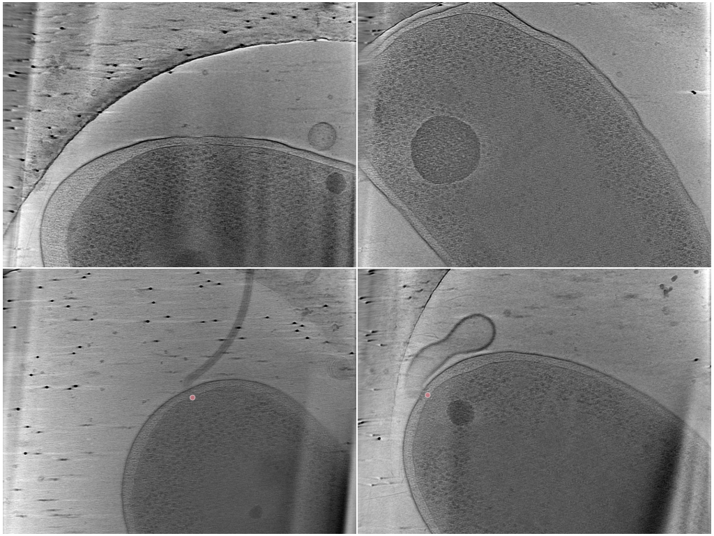 key visualization for BYU - Locating Bacterial Flagellar Motors Challenge Test Dataset