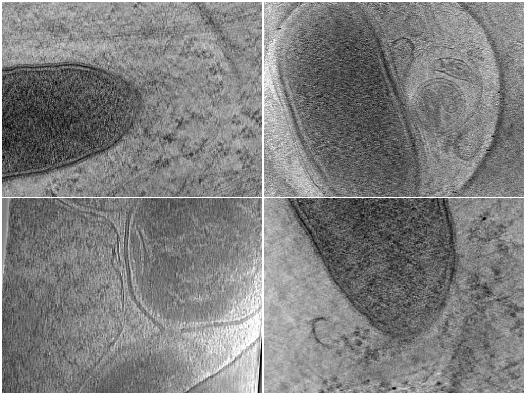 key visualization for Cryo-electron tomography of the Rickettsia parkeri cell surface reveals OmpB is required for the S-layer