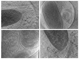 key visualization for Cryo-electron tomography of the Rickettsia parkeri cell surface reveals OmpB is required for the S-layer