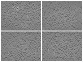 key visualization for Cryo-electron tomography of purified E. coli 70S ribosomes acquired by fast-incremental single-exposure (FISE) tilt series