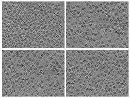 key visualization for PACE-tomo of purified Escherichia coli 70S ribosomes
