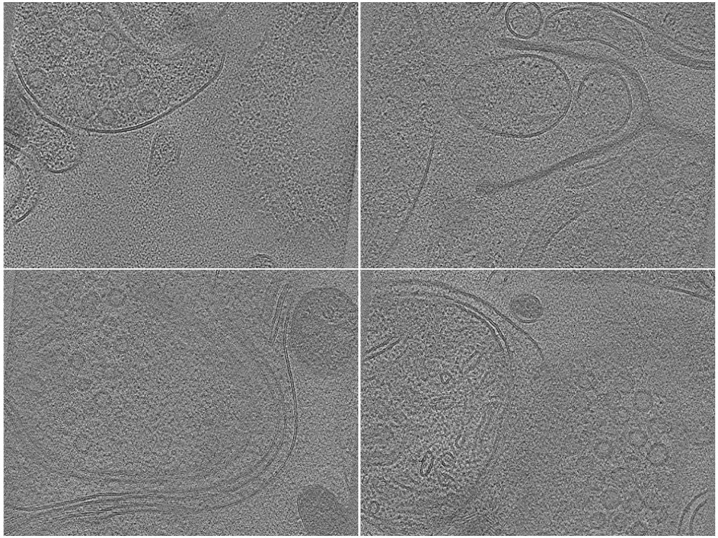 key visualization for A generalizable and targeted molecular biopsy approach for in situ cryogenic electron tomography of vitreous brain tissue