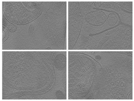 key visualization for A generalizable and targeted molecular biopsy approach for in situ cryogenic electron tomography of vitreous brain tissue