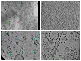 key visualization for Octopi and TopCup particle picks for a self-configuring in situ cryoET structure-determination workflow
