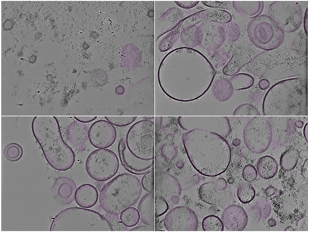 key visualization for AreTomo3 reprocessing of isolated synaptic vesicle tomograms (EMPIAR-12794)