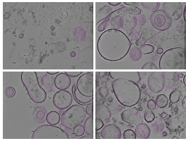 key visualization for AreTomo3 reprocessing of isolated synaptic vesicle tomograms (EMPIAR-12794)
